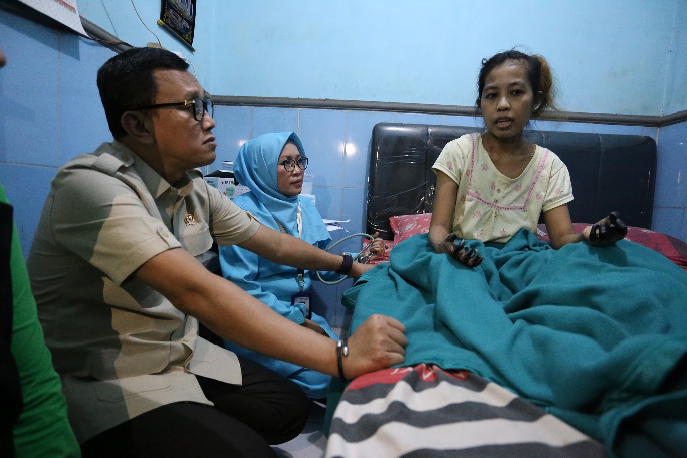 Usai Koma 9 Hari, Tangan dan Kaki Warga Jember yang Menjadi PMI di Singapura Menghitam