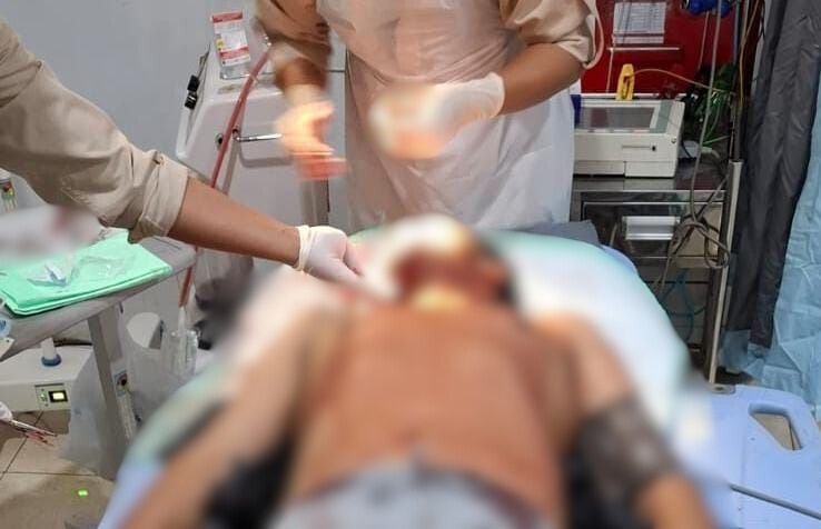 Warga Balung Jember Luka Parah Akibat Dibacok Tetangganya di Pasar, Apa Pemicunya?